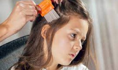 இயற்கை முறையில் பேன்   தொல்லையில் இருந்து விடுபட சில டிப்ஸ் .