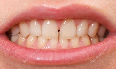 உங்கள் பற்களின் இடையே இடைவெளி இருந்தால் அதனால்  ஏற்படும் அதிர்ஷ்டம்.